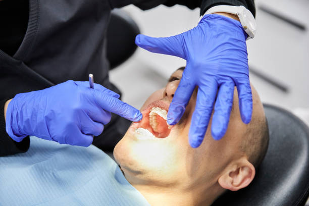 Best Emergency Care for Gum Disease in Irvington, NY