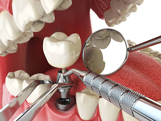 Best Walk-In Emergency Dental Services in Irvington, NY